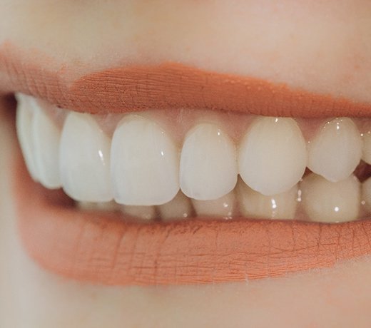 Closeup of patient with dental bridge in Brownstown