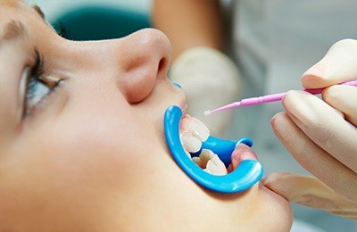 child getting fluoride treatment