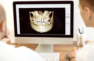 Dental patient having a dental implant consultation