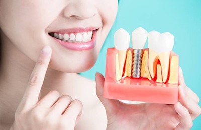 Woman smiling while holding model for dental implants in Brownstown