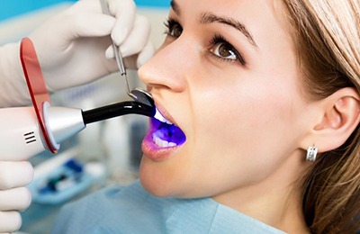woman getting dental sealants