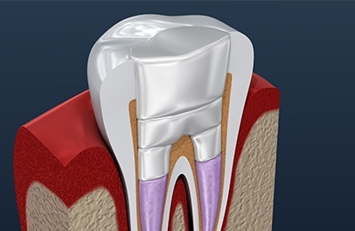 computer generated tooth