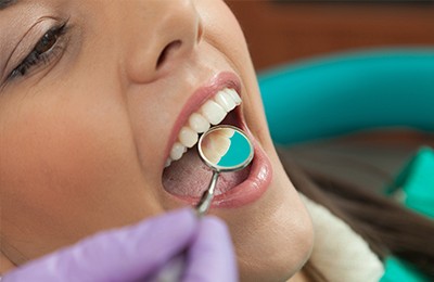 mirror showing back of womens teeth