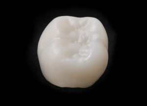 ceramic dental crown