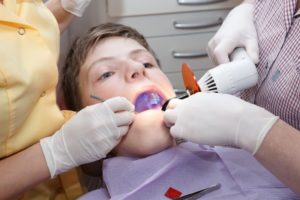 boy mouth open receiving dental sealant