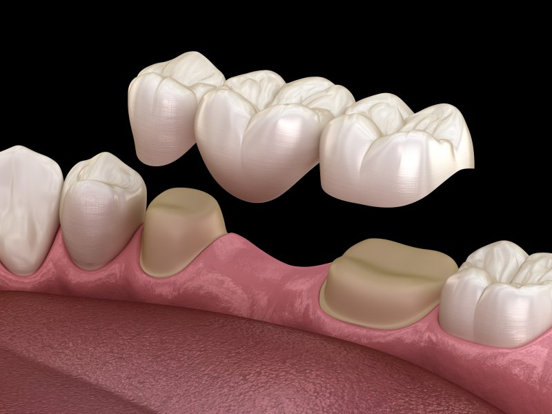 Ultimate Dental Blog -